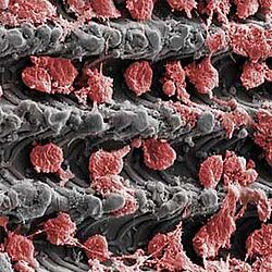 Laser-Lok microchannels