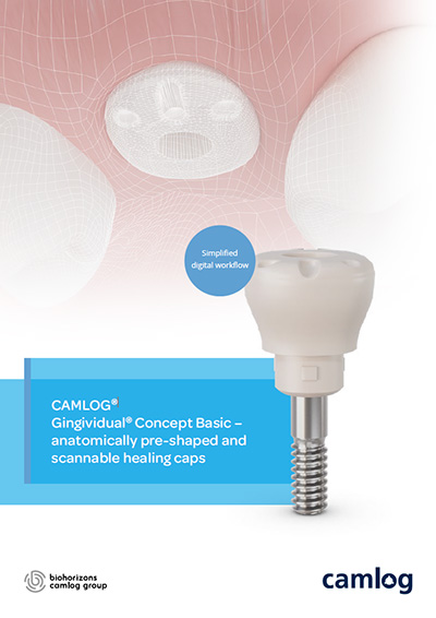 Flyer preview image: CAMLOG Gingividual Concept Basic – anatomically pre-shaped and scannable healing caps. Simplified digital workflow.