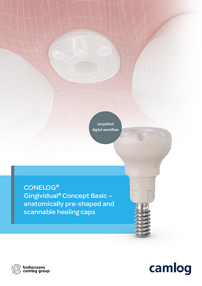 Flyer preview image: CONELOG Gingividual Concept Basic – anatomically pre-shaped and scannable healing caps. Simplified digital workflow.